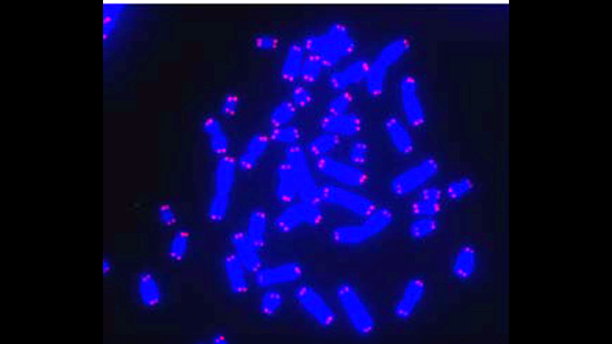 Human chromosomes (blue) with telomeres glowing pink at each tip, visualized under fluorescence microscopy. These protective caps shorten with every cell division until the cell dies. Epitalon reactivates the enzyme that rebuilds them.